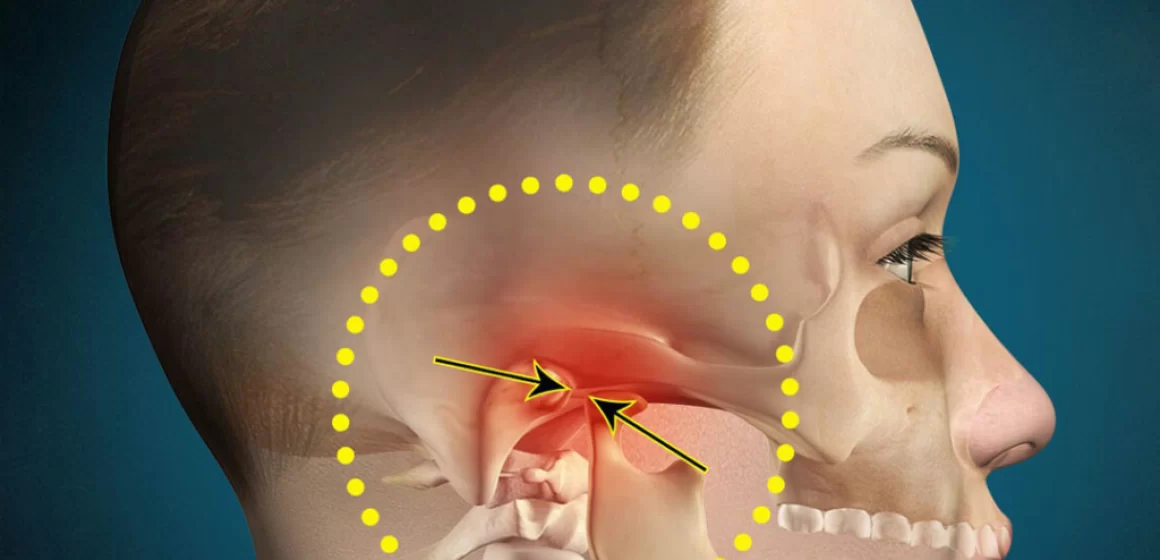 Tratamento para Disfunção Temporomandibular (DTM)